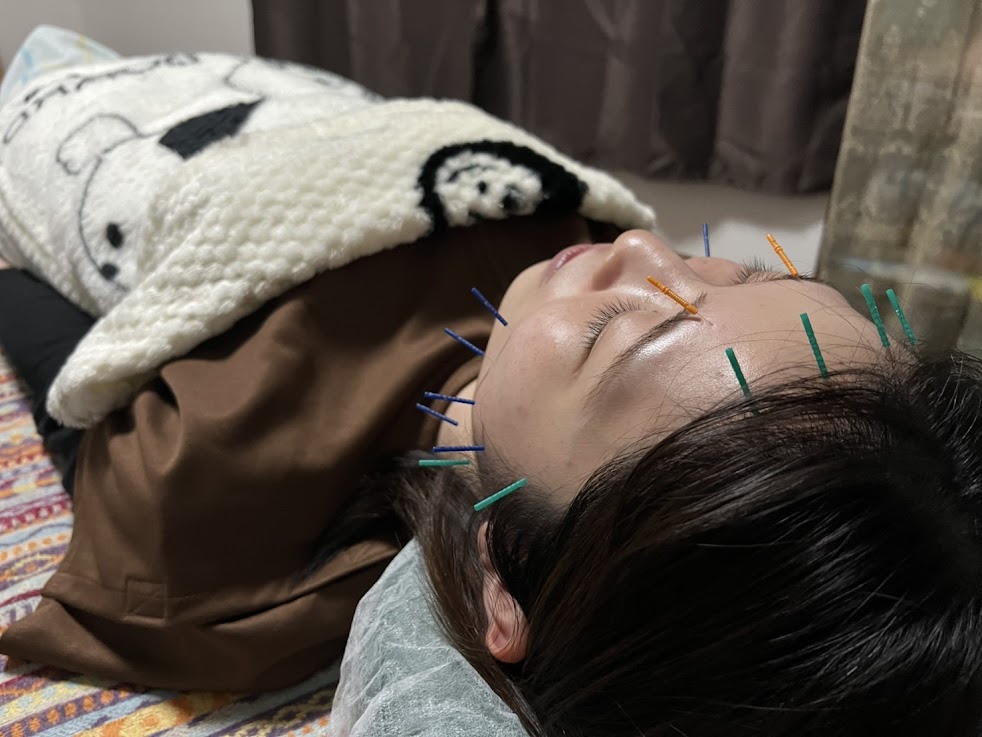 助ルポ鍼灸院