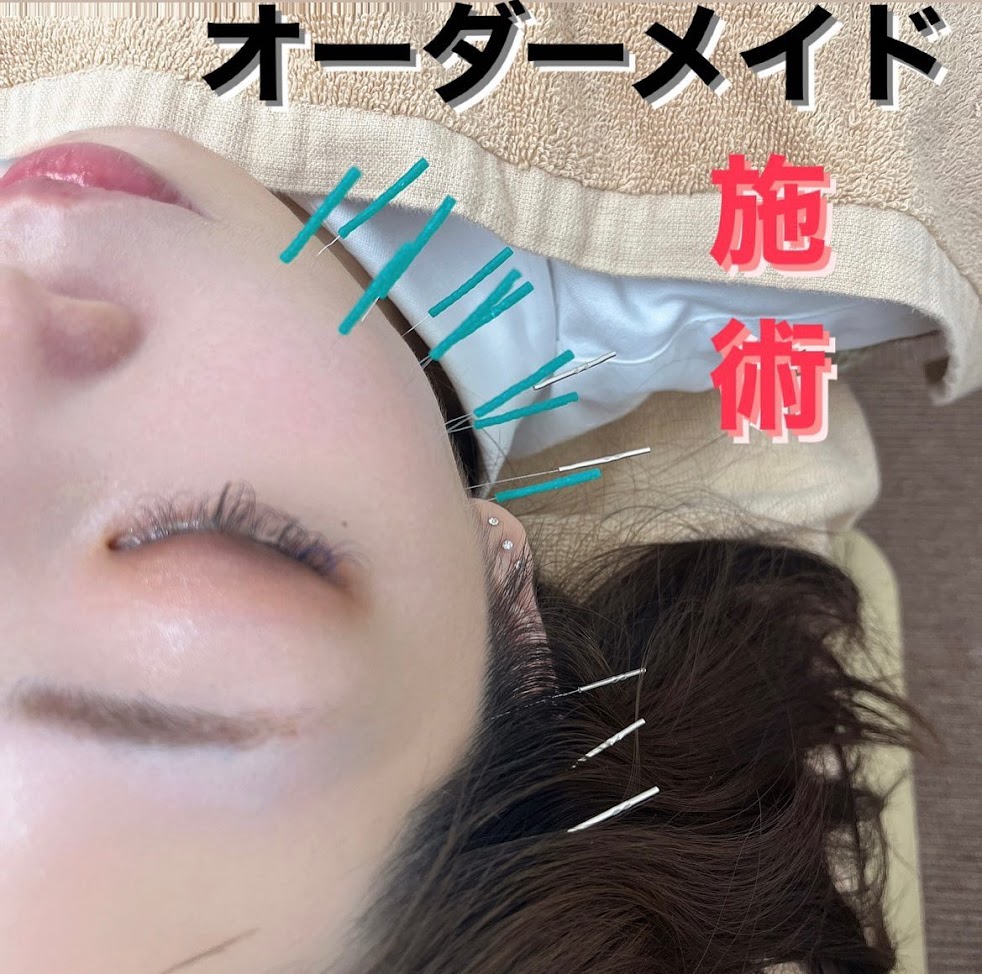 美容鍼通い放題サロン ハリナチュレ 沖縄那覇店