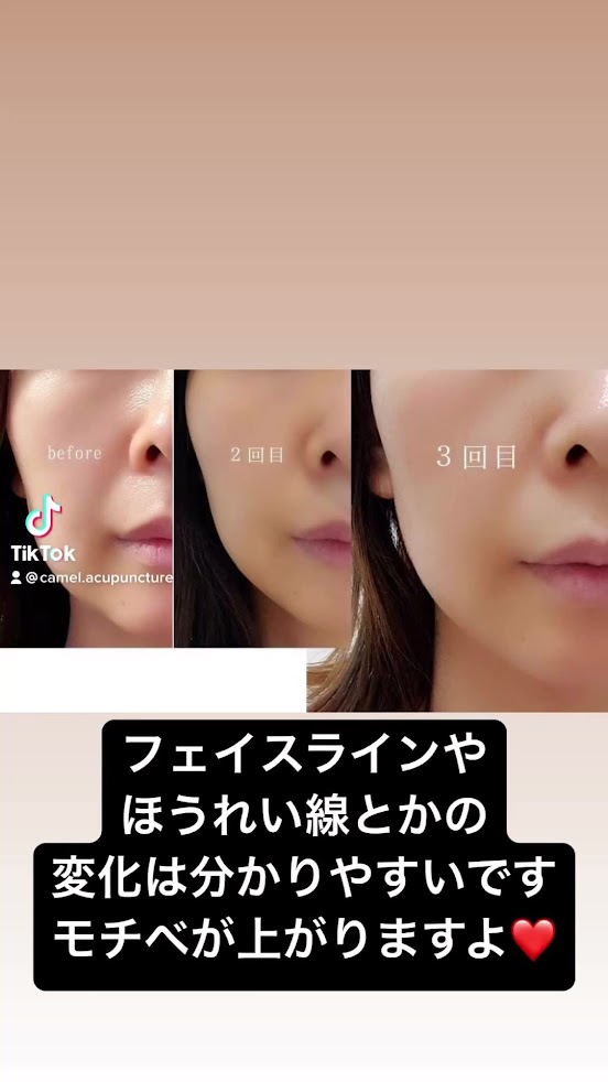 白山らくだ美容鍼灸整体院西巣鴨店