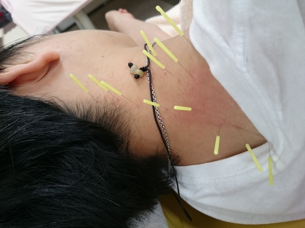 小松通り整骨院鍼灸院
