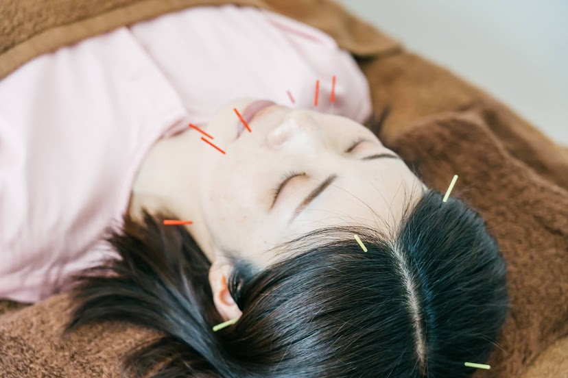 女性のための鍼灸院 teate（テアテ）