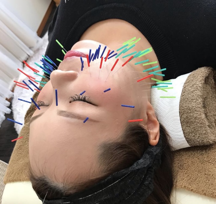 さや鍼灸院