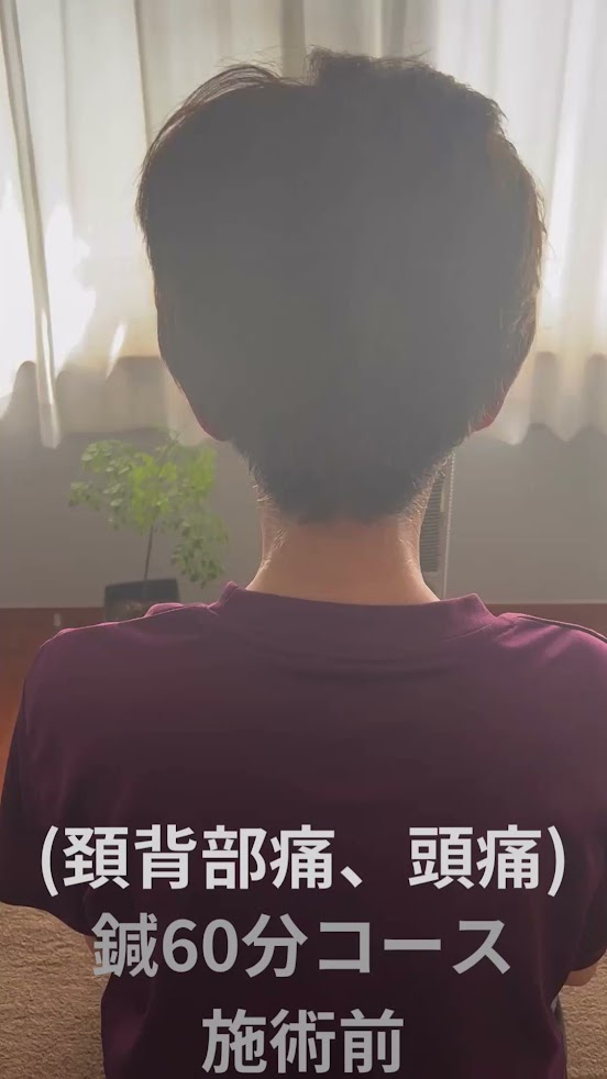 MOTO鍼灸院